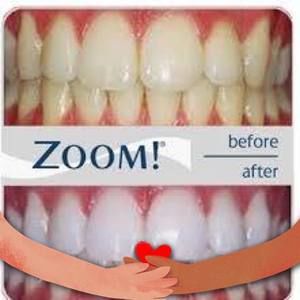 Meet your Posher, Todd